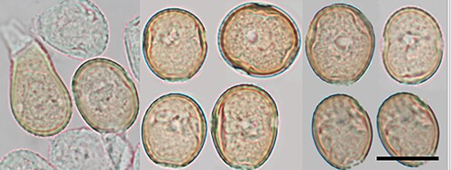 Figure 7. Puccinia cardamines on Cardamine glara: Urediniospores. Scale bar = 20 μm.