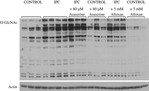 Figure 2. Representative O-GlcNAc (CTD 110.6) and actin immunoblots from control, IPC, control + 80 μM azaserine, IPC + 80 μM azaserine, control + 5 mM alloxan, and IPC + 5 mM alloxan.