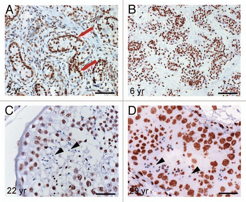 Figure 4 Immunohistochemical staining detecting global DNA-methylation in different testis samples using 5-mC antibody. (A) Red arrows point at spermatogonia of a testis from 2-year-old patient being positive for 5 mC antibody. (B) Testis section of a 6-year-old patient shows global hypermethylation of spermatogonia, too. (C and D) Spermatids and sperm of donors age 22 and 29 show global hypomethylation (arrowheads). Scale-bars: A and B: 200 µm; C and D: 50 µm.