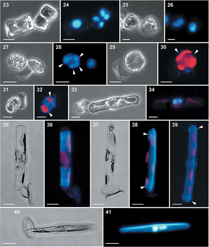 Figs 23–41. Light and epifluorescence micrographs of auxosporulation in Fragilariopsis kerguelensis. 23. Two appressed gametangia in girdle view; the cell on the right shows the cleavage of cytoplasm (cytokinesis) (cross L2D6 × L9C3, experiment C). 24. The same gametangia with DAPI-stained nuclei; the cell on the left has an expanded nucleus in meiotic prophase, the cell on the right has undergone the second meiotic division and each protoplast has two nuclei. 25. A gametangium after completion of cytokinesis and the formation of two gametes (cross L2D6 × L9C3, experiment C). 26. The same gametangium with DAPI-stained nuclei; each gamete has two nuclei. 27. A zygote still attached to a theca of the gametangium (cross L2D6 × L9C3, experiment C). 28. The same zygote with four DAPI-stained nuclei (arrowheads). 29. A zygote still attached to a theca of the gametangium (cross PA_P8B1 × MM_P13D2, experiment B). 30. The same zygote stained with PDMPO, showing thin siliceous platelets in its wall (arrowheads). 31. A young auxospore still attached to one theca of a gametangium (cross PA_P8B1 × MM_P13D2, experiment B). 32. The same auxospore stained with PDMPO, showing thin siliceous platelets at both ends of the auxospore (arrowheads). 33. An elongating auxospore still attached to one theca of a gametangium (mix of different strains in experiment A). 34. The same auxospore with two DAPI-stained nuclei. 35. An elongated auxospore still attached to the theca of a gametangium; mix of different strains in experiment A). 36. The same auxospore stained with PDMPO, showing the bands of the transverse perizonium. 37. An elongated auxospore still attached to the theca of a gametangium (mix of different strains in experiment A). 38. The same auxospore stained with PDMPO, showing the terminal bands of the transverse perizonium (arrowheads) and the longitudinal perizonium. 39. An elongated auxospore; the sample was incubated with PDMPO and the internal longitudinal perizonium, the thin bands of the transversal perizonium and the terminal caps (arrowheads) are visible (cross PA_P8B1 × MM_P13D2, experiment B). 40. A mature auxospore within which one valve of the initial cell has been deposited (mix of different strains in experiment A). 41. The same auxospore with two DAPI-stained nuclei and PDMPO-stained valve (on the top side). Scale bars = 10 µm.