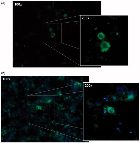 Figure 5. Microscopic images of MCF-7 human breast cancer cells incubated with coumarin-6 loaded nanoparticles after (a) 24 h and (b) 48 h.