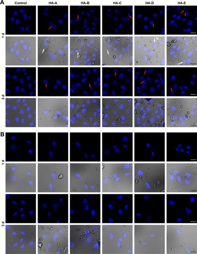 Figure 4 The typical CLSM images of A375 (A) and HSF (B) cells stained with DAPI (blue) after culturing with various HANPs at the concentration of 200 μg/mL for 1 and 3 days (both fluorescence field and superimposed pictures of the bright and fluorescence fields are given in the figure; magnification: ×100; scale bars: 20 μm; white arrow: vacuoles presented on nuclear membrane; red arrows: nuclear shrinkage or fragmentation; the dispersed HANPs are seen in the superimposed pictures; three duplicates for each experiment).Abbreviations: CLSM, confocal laser scanning microscopy; HANP, hydroxyapatite nanoparticle; HSF, human epidermal fibroblasts.
