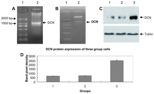 Figure 1 Construction and identification of pcDNA3.1-DCN and its expression in HepG2 cells. (A) Agarose gel electrophoresis of polymerase chain reaction product. Lane 1 represents DNA marker DL 2000 and lane 2, the decorin gene. (B) Detection of pcDNA3.1-DCN on gel electrophoresis after digestion by double restriction enzyme EcoRI and Xba I, lane 1 represents DNA marker DL 2000, and lane 2, double enzyme digestion results. (C) Decorin expression of three groups. Lane 1, lane 2, and lane 3, respectively, showed the decorin expression of the control, empty vector, and pcDNA3.1-DCN groups. The results were shown to be representative in three repeated experiments. (D) The decorin protein expression results were quantified based on three experiments and are represented as the mean ± standard deviation.