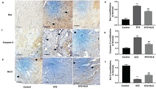 Figure 6 Effect of Ganoderma lucidum spores (GLS) on the protein expression of Bax, caspase 3 and Bcl-2 in cardiac tissues according to immunohistochemical micrographs (A, C, E), magnification 200×, arrows indicate the areas changed, and respective statistical analysis (B, D, F). Values represent the mean ± SE; n = 3 in each group. **, p < 0.01 versus the control group and ##, p < 0.01 versus the STZ group using Tukey’s test. Control: 5 mL/kg saline (p.o.); Diabetic: 50 mg/kg streptozotocin (i.p.) and 5 mL/kg saline (p.o.); STZ + GLS: 50 mg/kg streptozotocin (i.p.) and 300 mg/kg GLS (p.o.).