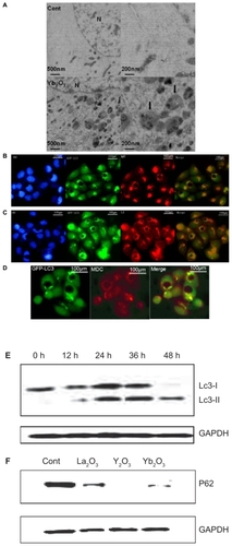Figure 2 The vacuolization of GFP-LC3/HeLa cells, induced by Y2O3, Yb2O3, is coupled with a typical autophagic process. A) Ultrastructural features of autophagosomes treated with PBS or 50 μg/mL of Yb2O3 for 2 days, as revealed by TEM. Right panels are high magnification images of left panels. Typical AVs (black arrows) are indicated, b–d. Autophagic marker dye staining assay on GFP-LC3/HeLa cells treated with 50 μg/mL Yb2O3 for 24 h. B) 10MM MDC, 15 min. C) 75 nM LysoTracker Red (LT), 15 min. D) 20 nM MitoTracker Red (MT), 15 min. Hoechst 33342 (HO) dye was used to show nucleus subcellular location. E) LC3 protein type conversion and the accumulation of LC3-ll in 48 h, Cells were treated with 50 μg/mL Yb2O3 and then subject to the western blotting. GAPDH was loading control. F) P62 protein degradation rate in autophagy pathway was measured by western blotting. Cells were treated with 50 μg/mL Yb2O3 for 24 h and then analyzed. GAPDH was loading control.