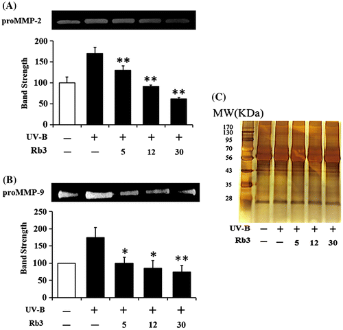 Fig. 4. Effect of Rb3 on the gelatinolytic activities of proMMP-2 (A) and proMMP-9 (B) in the conditioned media obtained from HaCaT keratinocyte cultures under irradiation with 70 mJ/cm2 UV-B radiation.