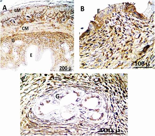 Figure 14. Immunohistochemistry showing caspase-3 streptavidin-biotin- peroxidase staining method in the uterus of adult female rat treated with (4 mg/kg of AgNps) high dose Showing positive and extreme expression of immune stain caspase-3.
