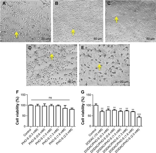 Figure 6 Cytotoxic effect of liposomal formulations on HUVECs.Notes: Results were obtained from three independent experiments. Photomicroscopy of HUVECs treated with PHO-S and DODAC/PHO-S liposomal formulation. (A) Control group: treatment with (B) PHO-S at 0.3 mM; (C) PHO-S at 2.0 mM; (D) DODAC/PHO-S (1:1) at 0.3 mM; (E) DODAC/PHO-S (1:1) at 2.0 mM. Viable cells are indicated by the arrow. Mean ± SD of cell viability treated with (F) PHO-S (0.3–2.0 mM); (G) DODAC (10 mM)/PHO-S (0.3–2.0 mM); (H) DODAC/PHO-S (1:1) (0.3–2.0 mM); (I) DODAC vesicles (0.3–2.0 mM). **P<0.01 and ***P<0.001; ns.Abbreviations: DODAC, dioctadecyldimethylammonium chloride; HUVECs, human umbilical vein endothelial cells; PHO-S, synthetic phosphoethanolamine; ns, not significant; SD, standard deviation.