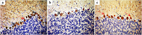Figure 4. Immunohistochemically stained cerebellar sections for Calbindin D28k showing (a) Intense cytoplasmic immunoreaction in many Purkinje cells (arrow) and their processes (red arrow) in control group. (b): Decreased intensity of immunoreactions in few Purkinje cells of group II (arrow). (c): Positive cytoplasmic immune reaction in Purkinje cells (arrow) and their processes (red arrow) of group III (Anti calbindin D28k ×400; Scale bar = 30 µm).