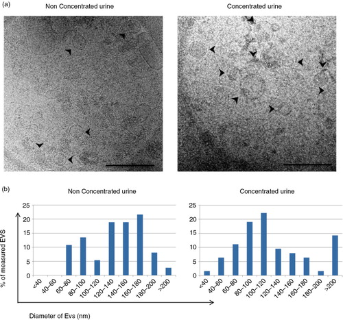 Fig. 5.  Analyses of the EVs obtained after SEC procedure by cryo-EM.Panel a shows a cryo-EM of vesicles contained in a tetraspanin-peak fraction from non-concentrated (left) and concentrated (right) samples. Scale bar is 500 nm. Arrows pointing at EVs. In panel b, the size of these vesicles was measured (diameter in nm) from a set of images of non-concentrated (left, n=36 EVs from 10 images) and concentrated (right, n=63 EVs, from 17 images) samples using ImageJ software (NIH).