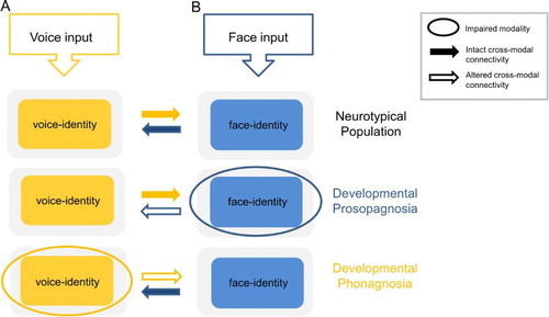 Figure 1. A schematic representation of the interactions between voice and face information, during identity processing based on unisensory input, in the neurotypical population, developmental prosopagnosia, and developmental phonagnosia. Neurotypical population. Auditory-only voice-identity processing (A) is facilitated by visual face-identity information in the FFA. The FFA shares connections with voice-sensitive regions in the a/m STS/G (solid yellow and blue arrows) (Blank et al., Citation2011; von Kriegstein et al., Citation2008; Schall et al., Citation2013). Although speculative, visual face processing (B) may also be facilitated by connections between these regions (see Bülthoff and Newell, Citation2015, for behavioural effects). Although the solid yellow and blue arrows are depicted here with equal strength, it is likely that the actual strength of the interactions will vary depending on the saliency of the unisensory input. Developmental prosopagnosia. Auditory-only voice-identity processing (A) does not benefit from prior face-voice learning owing to impaired face-identity processing. Although connections between the FFA and STS/G exist in this cohort (von Kriegstein et al., Citation2006; Schall & von Kriegstein, Citation2014), they are not sufficient to optimise speaker recognition. This is likely owing to atypical recruitment of the FFA during voice-identity processing which may alter the nature of the information transferred between these regions (outline blue arrow) (von Kriegstein et al., Citation2006, Citation2008). Hypothetically, visual face processing (B) could be enhanced through audio-visual face-voice learning in this cohort (solid yellow arrow). Developmental phonagnosia. Auditory-only voice-identity processing (A) may be enhanced through compensatory recruitment of intact visual face-identity mechanisms (solid blue arrow) (Roswandowitz et al., Citation2014; Roswandowitz et al., Citation2017). However, visual face processing (B) may not benefit from additional vocal information in this cohort, owing to the failure to represent the voice at the level of the individual identity (outline yellow arrow).