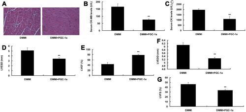 Figure 2 PGC-1α prevented diabetes mellitus with myocardial infarction in mice. The protein structure of PGC-1α (A), serum CK-MB (B), CK (C), LVESD (D), LVEF (E), LVEDD (F), LVFS (G) levels. DMMI, DMMI mice group; DMMI+PGC-1α, DMMI mice with PGC-1α group. **p<0.01 versus DMMI mice group.