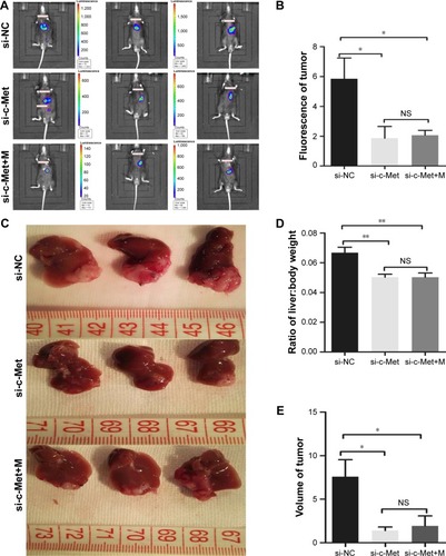 Figure 6 Tumor growth inhibition mediated by Gal-PEI-SPIO/si-RNA in vivo.Notes: (A) The D-luciferin fluorescence intensity of mice bearing tumors. (B) The measurement of fluorescence intensity in different groups. (C) The tumor at final time point of treatment. (D) The ratio of liver:body weight of difference groups. (E) The volume of tumor. si-NC, Gal-PEI-SPIO/NC siRNA; si-c-Met; Gal-PEI-SPIO/si-c-Met siRNA; si-c-Met+M, Gal-PEI-SPIO/si-c-Met siRNA with addition of extra magnet. *P<0.05; **P<0.01.Abbreviations: Gal-PEI-SPIO, galactose-polyethylenimine-superparamagnetic iron oxide; M, magnet; NC, negative control; NS, non-significance.