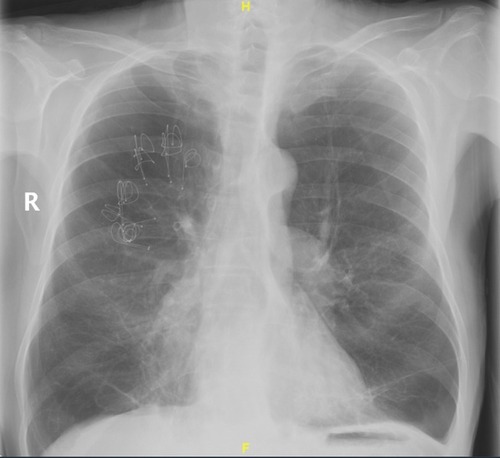 Figure 2 The radiological view.