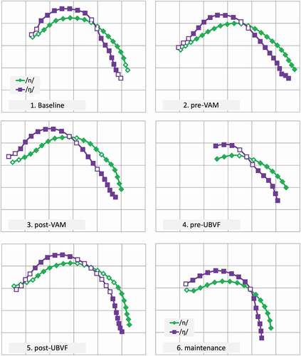 Figure 2. Mean midsagittal tongue surface curves of /n/ (green) /ŋ/ (purple) from minimal pair probes in assessment sessions one to six (tongue tip to the left, on a 1 cm grid, with a 22.5° rotation). Co-radial solid markers indicate a significant radia.