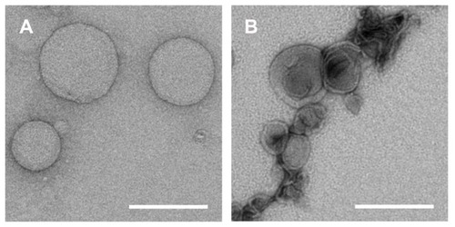 Figure 5 Transmission electron micrographs with negative staining technique of (A) uncoated POPC/DOPE-MCC liposomes and (B) POPC/DOPE-MCC liposomes coated with chitosan-TGA (4:1 molar ratio of SH-groups to maleimide groups).Notes: Magnification: 30,000×. Scale bar indicates 200 nm.Abbreviations: DOPE-MCC, 1,2-dioleoyl-sn-glycero-3-phosphoethanolamine-N-[4-(p-maleimidomethyl)cyclohexane-carboxamide]; POPC, Palmitoyl-oleoyl-phosphatidylcholine; TGA, thioglycolic acid.