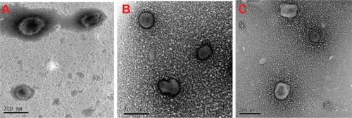 Figure 5 Transmission electron micrographs of conventional liposomes (A), blank (B), and recombinant human insulin-loaded sodium glycocholate liposomes (C).