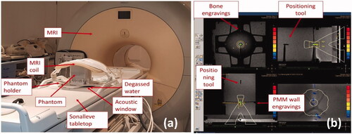 Figure 2. Experimental set up for the MR-HIFU Sonalleve system – (a) the test object is positioned in contact with the acoustic window and degassed water is added to minimize potential air gaps. A phantom holder was specifically manufactured to be compatible with the phantom and the Sonalleve system. The holder allows phantom positioning and alignment. The MRI coil is positioned on top of the phantom for signal acquisition; – (b) positioning tools and engravings on the bone-mimicking components are visible on the MR image and help identify thermocouple positions in 3 D space. The console provides coronal (top-left), sagittal (top-right), transverse (bottom-left) and near-field views (bottom right) of the phantom. Sonication were performed with treatment cells of 4 mm diameter and powers ranging from 20 W to 60 W.