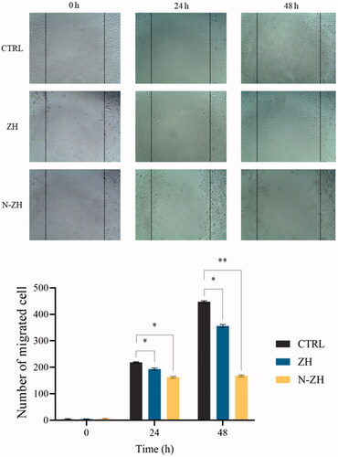 Figure 6. N-ZH attenuates the migration of A549 cells. The healing ability of A549 cells in N-ZH-treated group was significantly weaker than that in the control and ZH-treated groups at 24 and 48 h after the wound was scratched. *p < .05 and **p < .01. Zein hydrolysate (ZH), Nano-liposomal ZH (N-ZH).