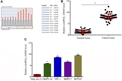 Figure 1 CircRNA_104565 was highly expressed in PTC tissue and cell. (A) GEO dataset (GSE93522) showed that circRNA_104565 was significantly increased in PTC tissues compared to normal tissues. (B) CircRNA_104565 expression was significantly increased in PTC tissues compared to normal tissues. (C) CircRNA_104565 was significantly increased in PTC cells compared to Nthy-ori-3–1. *P < 0.05.