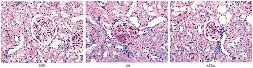 Figure 1. Morphological characteristics of glomerulus under light microscopy in three groups. Collagen deposition was markedly observed in the GS group when compared with the SHO group. The pathological changes in the ATRA group were remarkably reduced when compared with those in GS group. SHO: sham operation group; GS: GS model group; ATRA: GS model group treated with ATRA. All PAS, ×400.