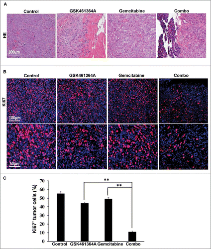 Figure 5. Histological analysis of Panc1-derived orthotopic xenograft tumors. A, Representative images of H&E on formaldehyde-fixed, paraffin-embedded Panc1-derived orthotopic xenograft tumors sections from different treatment groups. B, Representative images of IFC staining for Ki67 on formaldehyde-fixed, paraffin-embedded Panc1-derived orthotopic xenograft tumors sections from different treatment groups. C, Microscopic quantification of Ki67 as percentages of Ki67-positive cells to total numbers of cells. Multiple tumor sections were calculated (mean ± SEM; n = 4). **, p < 0.01.