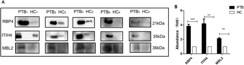 Fig. 4 Comparison of candidate differential proteins using immunoblotting.Samples were analyzed using immunoblotting to facilitate comparisons of RBP4, ITIH4-35k, and MBL2 levels (a). Twenty-five pulmonary tuberculosis (PTB) patients and 25 healthy controls (HC) were randomly divided into five subgroups (PTB1 to PTB5; HC1 to HC5), each containing five individuals. The samples of each subgroup were pooled and detected in one lane, and each pair consisted of PTB patients and healthy control subgroups. b The densitometry quantification of the results of (a) using Image J software; p-values between the two groups with the two-tailed unpaired t-test. **p < 0.01, ***p < 0.001