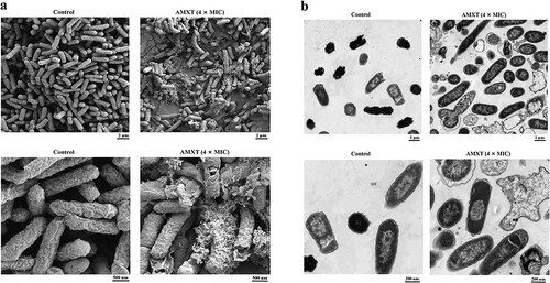 Figure 4. AMXT-1501 destroys bacterial cell membranes of E. coli. (a) E. coli ECO2219 (CRE) was treated with AMXT-1501 (AMXT) for 2 h and observed by SEM. (b) E. coli ECO2219 (CRE) was treated with AMXT-1501 for 2 h, and observed by TEM. Representative fields are shown in all panels. AMXT, AMXT-1501; MIC, minimum inhibitory concentration; CRE, carbapenem-resistant Enterobacteriaceae.