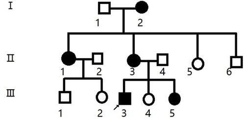Figure 1 Family pedigree. Black symbols indicates affected individuals; open symbols indicates unaffected individuals; square indicates male; circle indicates female; arrow indicates proband.