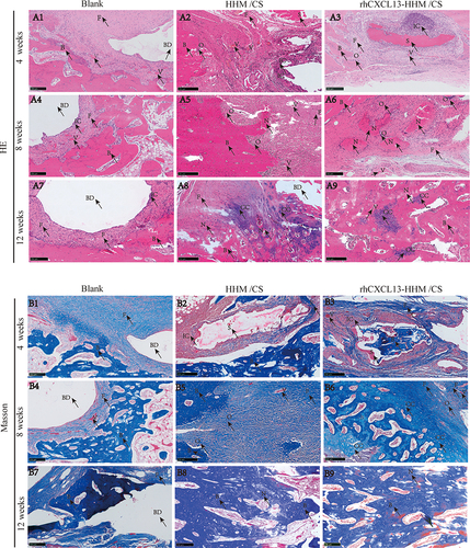 Figure 11 H&E and Masson Staining of Bone Defect Repair Across Different Groups: (A) Representative H&E staining images of bone defect repair at 4, 8, and 12 weeks in different groups. (A1-A9). (B) Representative Masson Staining images of bone defect repair at 4, 8, and 12 weeks in different groups. (B1-B9). The H&E and Masson Staining analysis of bone defect repair in rhCXCL13-HHM/CS scaffold is superior to other groups, indicating a better bone repair effect.