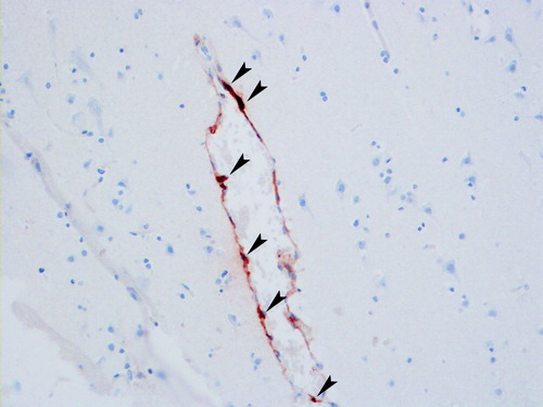 Figure 1.  Tryptase-stained section of human brain showing mast cells (arrow-heads) in typical perivascular position.