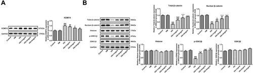 Figure 3 KDM7A expression is increased by HG induction, while KDM7A expression is inhibited by catalpol. (A) The Western blot analysis detected the KDM7A expression in HG-induced MC3T3-E1 cells (n=3). *P<0.05, **P<0.01 and ***P<0.001 vs. control group. #P<0.05, ##P<0.01 and ###P<0.001 vs. HM group. ∆P<0.05 vs. HG group. (B) The expression of Wnt/β-catenin signaling pathway in HG-induced MC3T3-E1 cells was detected by Western blot analysis (n=3). *P<0.05, **P<0.01 and ***P<0.001 vs. control group. #P<0.05, ##P<0.01 and ###P<0.001 vs. HM group. ∆P<0.05 and ∆∆∆P<0.001 vs. HG group.