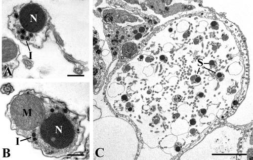 Figure 3. TEM micrographs.A, spermatozoon with electron‐dense nucleus (N) and inclusions (I) (scale bar, 0.5 µm); B, section of a spermatozoon showing the co‐presence of nucleus (N) and mitochondrion (M). I, inclusions (scale bar, 0.4 µm); C, an almost empty cyst including only some spermatozoa (S) (scale bar, 6 µm).