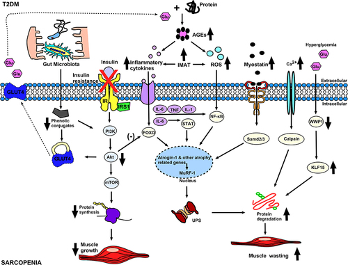 Figure 2 The possible mechanism of diabetes and sarcopenia. In diabetes, insulin resistance inhibits protein synthesis pathways leading to decreased muscle mass. The increase of inflammatory cytokines, ROS, Myostatin and Calpain related to diabetes will not only inhibit the protein synthesis pathway, but also increase the protein catabolism pathway, thereby causing further decline in muscle mass. Hyperglycemia causes decrease of WWP1, which leads to increase of KLF15, which further aggravates the protein catabolic pathway and leads to muscle atrophy.