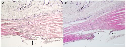 Figure 6 The anterior chamber angle following TrabEx goniotomy showed partial removal of trabecular meshwork with large leaflet tissue remnants (ranging from 100–200 µm in length, arrows) over the Canal of Schlemm (SC) in both (A and B). H&E stained sections, scale bar = 200 µm.