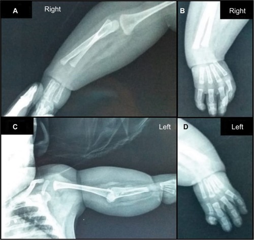 Figure 2 X-ray images of the upper limbs.