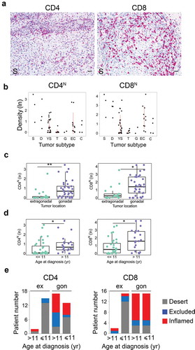 Figure 3. Density of tumor-infiltrating CD4+ and CD8+ T-cell subsets in meGCTs a. Representative IHC images for CD4+ and CD8+ T-cell staining in primary meGCT samples. T-cell subsets are in red. Nuclei were counterstained with hematoxylin (blue). Original magnification, x20. Scale bar, 30 µm. b, Distribution of CD4+ and CD8+ T cells in nest regions of meGCT subtypes. c and d, Box plots of CD4+ and CD8+ T cells in nest regions according to the tumor location and age at diagnosis, respectively. e, Distribution of tumor-infiltrating CD4+ and CD8+ T cells in meGCT patients according to tumor location and age at diagnosis. S, seminoma; D, dysgerminoma; YS, yolk sac tumors; T, teratoma; G, gonadoblastoma; EC, embryonal carcinoma; C, choriocarcinoma. *p < 0.05. **p < 0.001.