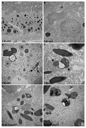 Figure 3. Phagosomes and autophagosomes in conditional knockout of CRYBA1 in RPE cells. (A) Transmission electron microscopy image from a 2-mo-old RPE of cryba1 cKO mouse showing phagosomes containing shed outer segment discs (arrows). Bar: 2 μm. (B) TEM showing the same phagosomes (as in A) at higher magnification to demonstrate that they are enclosed by a single membrane. Bar: 500 nm. (C) A 5-mo-old cryba1 cKO mouse RPE shows autophagosomes with double membranes (arrows). M designates mitochondria, which also have double membranes. Bar: 500 nm. (D) TEM images from RPE of a 7-mo-old cryba1 cKO mouse showing an autophagosome with double membrane (arrows). Bar: 500 nm. (E) A 12-mo-old starved Cryba1fl/fl mouse RPE shows a phagosome containing shed outer segment discs (arrow). Bar: 500 nm. (F) TEM showing an autophagosome with double membrane (arrows) in a 12-mo-old Cryba1fl/fl mouse following starvation. Bar: 500 nm.