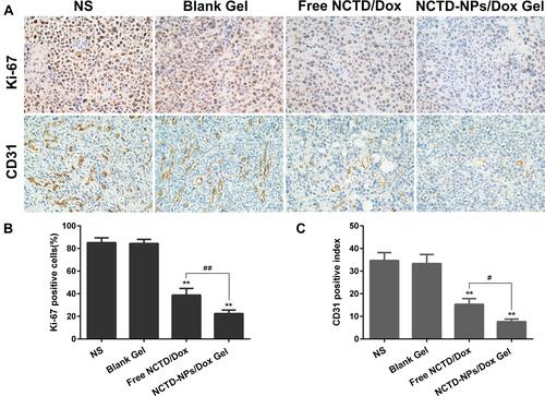 Figure 7 (A) Representative images of immunohistochemical analysis of each group for the evaluation of Ki-67 and CD31 (×400). (B) The quantitative analysis of Ki-67 expression in each group. (C) The quantitative analysis of vascularization in each group.