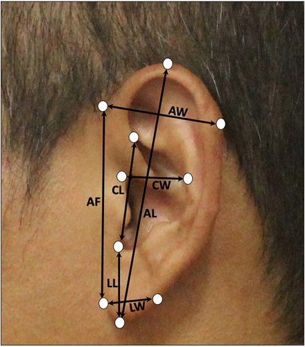 Figure 1 Auricular Anthropometric Parameters. Auricle length (AL): Distance from superaural to subaural. Auricle width (AW): Distance from preaural to postaural in helix area. Auricle floor (AF): Distance from anterior lobule to preaural. Lobule length (LL): Distance from subaural to inferior intertragic notch. Lobule width (LW): Distance from posterior lobule to anterior lobule. Conchal length (CL): Distance from superior turbinate to inferior intertragic notch. Conchal width (CW): Distance from the posterior notch of the auricle anterior part to the helical curvature in antihelix area.