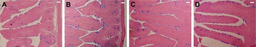 Figure 4 Alcian blue staining of jejunum sections showing goblet cells in (A) control mice, (B) infected mice, and infected mice treated with (C) NaSe and (D) SeNPs. N=5. Scale bar=100 μm.Abbreviations: NaSe, sodium selenite; SeNPs, selenium nanoparticles.