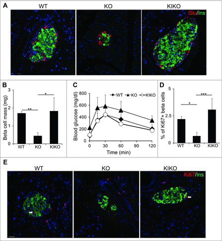 Figure 5. Reconstituting cyclin D2 expression restores β cell mass, function, and regenerative capacity. (A) Representative immunofluorescence staining glucagon (red), insulin (green) and DAPI (blue) in 6-week-old WT, KO, and KIKO mice. (B) Quantification of β cell mass in 6-week-old WT, KO, and KIKO mice. (C) GTT was performed in 3-month-old WT, KO, and KIKO mice. (D, E) Representative immunofluorescence staining (F) and quantification (E) for insulin (green), Ki67 (red), and DAPI (blue) in 6-week-old WT, KO and KIKO mice treated with a single dose of STZ (90 mg/kg). White arrows indicate Ins+Ki67+ cells. Data shown as mean ± SD (n = 3 mice per group). * P < 0.05, **P < 0.01, ***P < 0.005.