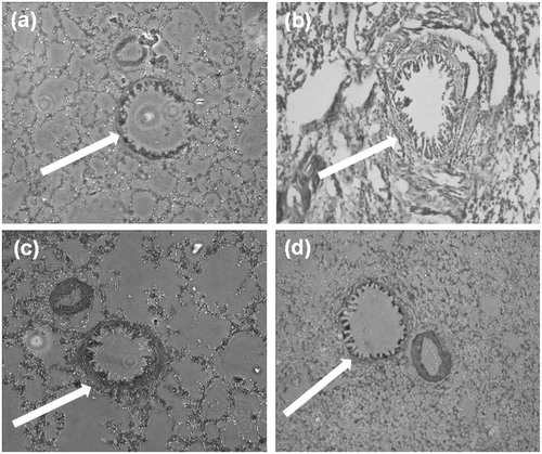 Figure 9. Histomicrographs of lung tissue of (a) normal control, (b) disease control, (c) positive control and (d) test group (MCD-KV-10) animals.