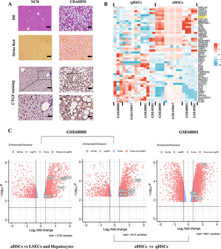 Figure 6 Expression and function identifications of CTGF in NASH liver fibrosis model of mice and human. (A) Histology of liver sections from NCD or CDAHFD-fed mice stained for CTGF, H&E, as well as Sirius red staining. Insert showing the typical CTGF-positive cells, lobular inflammation, and pericellular fibrosis. Scale bars: 100 μm (up 3 panels) and 200 μm (bottom panel). (B) Heatmap depicting the representative DEGs (sorted by fold change and p value) in the human quiescent HSCs (qHSCs) and human activated HSCs (aHSCs). CTGF is among the top DEGs and is highlighted in yellow. Database-based gene expression analysis was conducted using public data sets obtained from GEO at site the NCBI (http://www.ncbi.nlm.nih.gov/geo/). (C) Volcano plots of DEGs between human activated HSCs (aHSCs) and human hepatocytes, liver sinusoidal endothelial cells (LSECs) (from GSE68000), and DEGs between human activated HSCs (aHSCs) and human quiescent HSCs (qHSCs) (from GSE68000 and GSE68001 respectively). Representative fibrogenesis-related genes including CTGF are labeled in the plots.