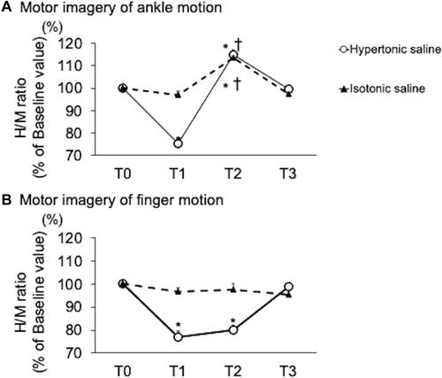 Figure 5 H/M ratio. Mean (SEM, n=10) H/M ratio after the infusion of hypertonic (open circle) or isotonic saline (black triangle). The data show H/M ratio after motor imagery of ankle motion (A) and hand motion (B). Although statistics were performed on raw values of the data, each number is indicated by the rate of change from Baseline (T0). Significantly different from T0 (*, NK: P<0.05), and T1 (†, NK: P<0.05). T0: Baseline, T1: Pre-intervention, T2: Post-intervention, T3: Recovery.