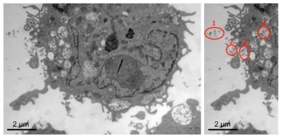 Figure 1 Representative image of THP-1 cell treated with 2.0 mM gadolinium shows several vacuoles containing gadolinium oxide nanoparticles and invaginations at the cell surface indicating phagocytic processes (left panel). Illustration of the phagocytic process: (1) nanoparticles in the extracellular fluid, (2) nanoparticles approaching the cell surface, (3) nanoparticles at the cell surface, and (4) nanoparticles internalized in cell vacuole (right panel).