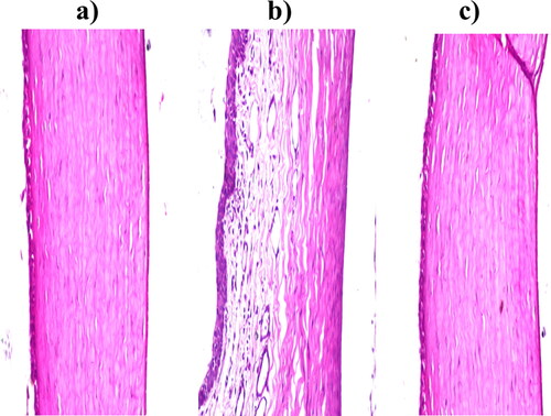 Figure 7. Photomicrographs of the rabbits’ corneas after instillation of; a) Normal saline solution (negative control), b) Isopropyl alcohol (positive control) and c) FTN-loaded optimum formula.