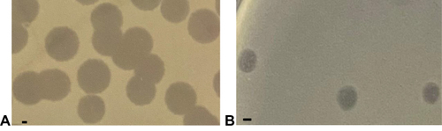 Figure 2 Plaques formed by bacteriophages (A) ΦJHS and (B) ΦSMK on the lawn of PA 1139 strain using the double agar overlay method. The bar corresponds to 1 mm.