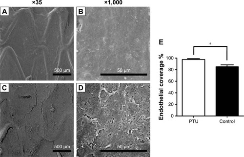 Figure 5 Endothelial coverage and morphology of the endothelial cell layer.Notes: Endothelial coverage on stent struts with (A and B) or without (C and D) PTU loadings (25 μg/mm2) at Week 3 is shown. Magnification ×500. Percentage of endothelial coverage on stent strut was counted and averaged (E). Each value represents the mean ± SE of measurements from six rabbits. *Represents significant difference.Abbreviations: PTU, propylthiouracil; SE, standard error.