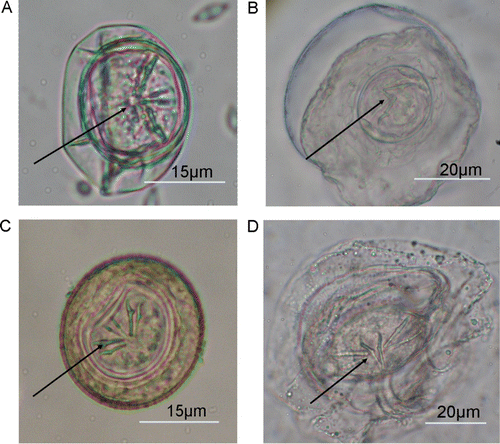 Figure 2  Cestode eggs from different passerine species. Note the hexacanth larvae inside the eggs (arrow). A, Blackbird. B, Tui. C, North Island saddleback (Mokoia). D, North Island saddleback (Orana Park).